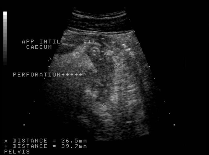 9t av Catherine Olsson, sonograf
